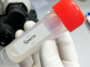 How to Get the Best Sperm Sample for IVF