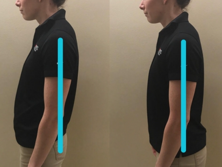 Postural Intervention Training for Kyphosis and Scapular Control 🧠🏋️♂️