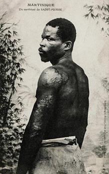 Louis-Auguste Cyparis