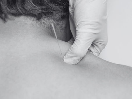 dry needling Edmonton