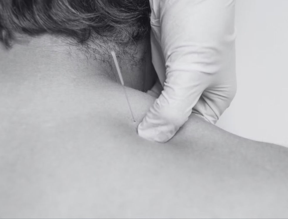 Understanding Nerve Sensitization and When IMS Can Help