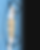 Composite Bonding Dental Dentist