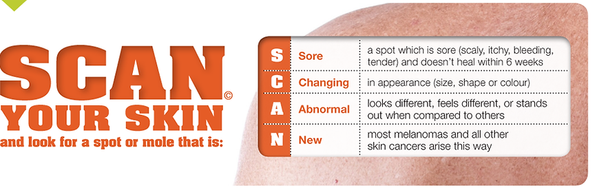 Checking for Skin Cancer