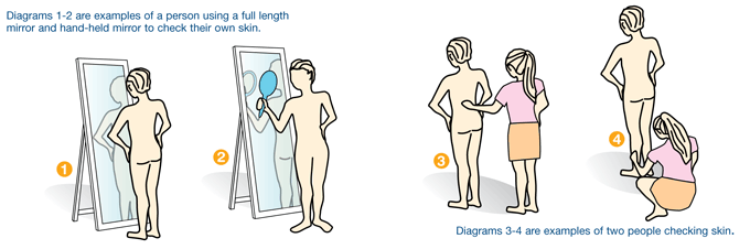 Skin Cancer Self Examination