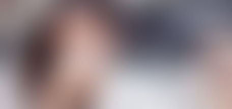 Temporary Blindness and Short-Term Vision Loss