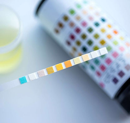 Urine Testing 5 panels