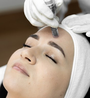 microneedling .jpg