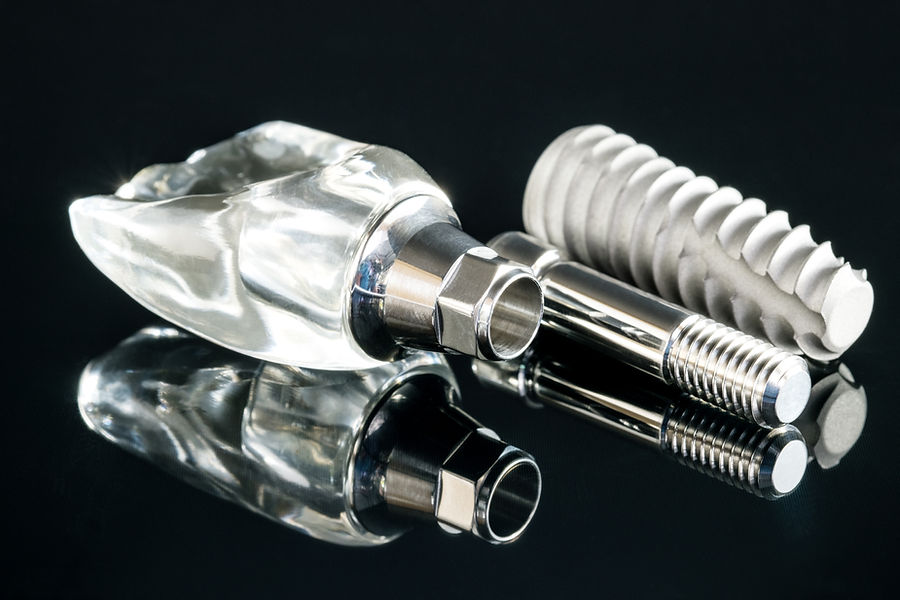close-up-dental-implant-model-black-back