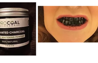 Teeth Whitening & Dental Health