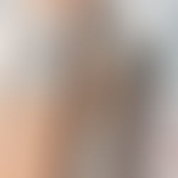 Hydrate your skin from summer