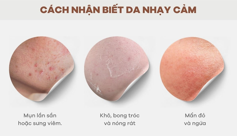 Cách nhận biết da nhạy cảm