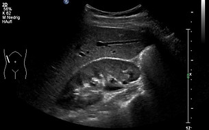 Abdomen.jpg