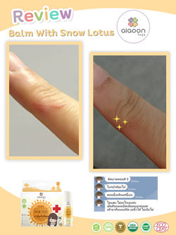 รีวิวบาล์ม มีดบาดมือ