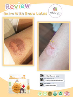 รีวิวบาล์ม โดนท่อดาด