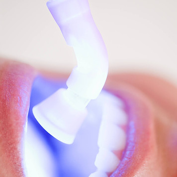 Clareamento dental - laser