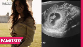 Angie Costa partilha ecografia do seu bebé: “Quando ouvi o coraçãozinho pela primeira vez...”