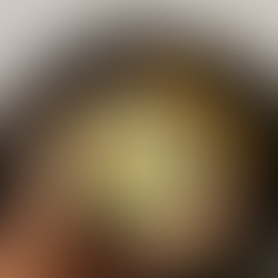 Mediterranean Diet Zucchini With Garlic Yogurt & Pine Nuts