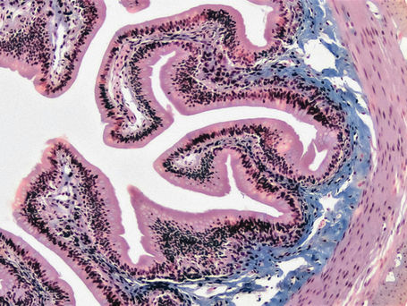 Gut Microbiome and Mental Health