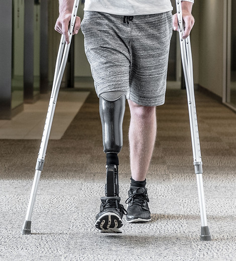 Prosthetic Leg-