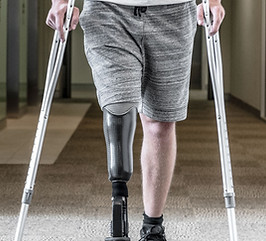 Prosthetic Leg