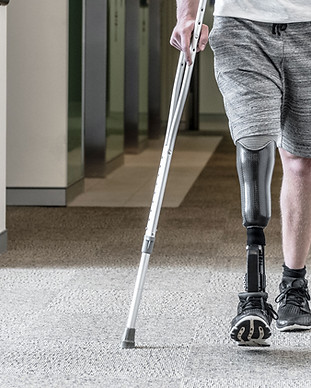 Prosthetic Leg
