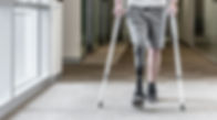 Prosthetic Leg