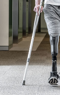 Prosthetic Leg-