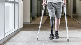 Prosthetic Leg