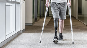 Prosthetic Leg