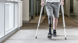 Prosthetic Leg-