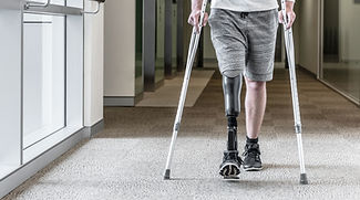 Prosthetic Leg