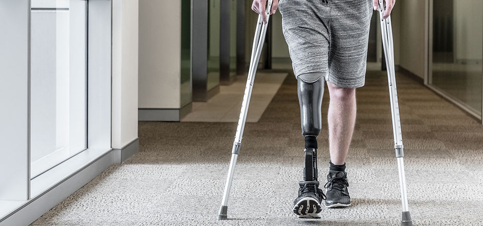 Prosthetic Leg-