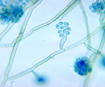 microbiology, microscopy image