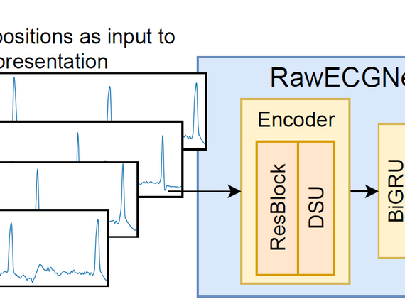 RawECGNet: Deep Learning Generalization for Atrial Fibrillation Detection from the Raw ECG