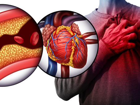 What is a Cardiac Diet?