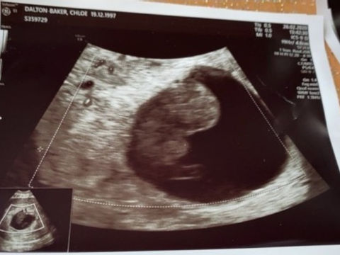 Baby Dalton Baker