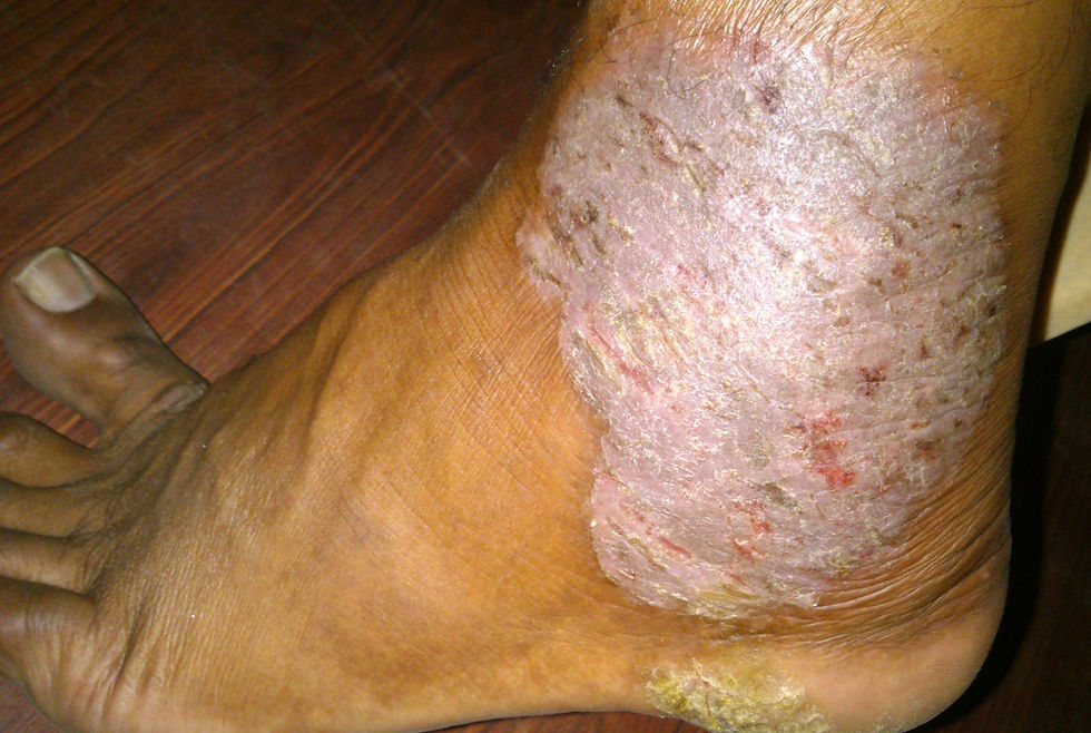 After Treatment.
