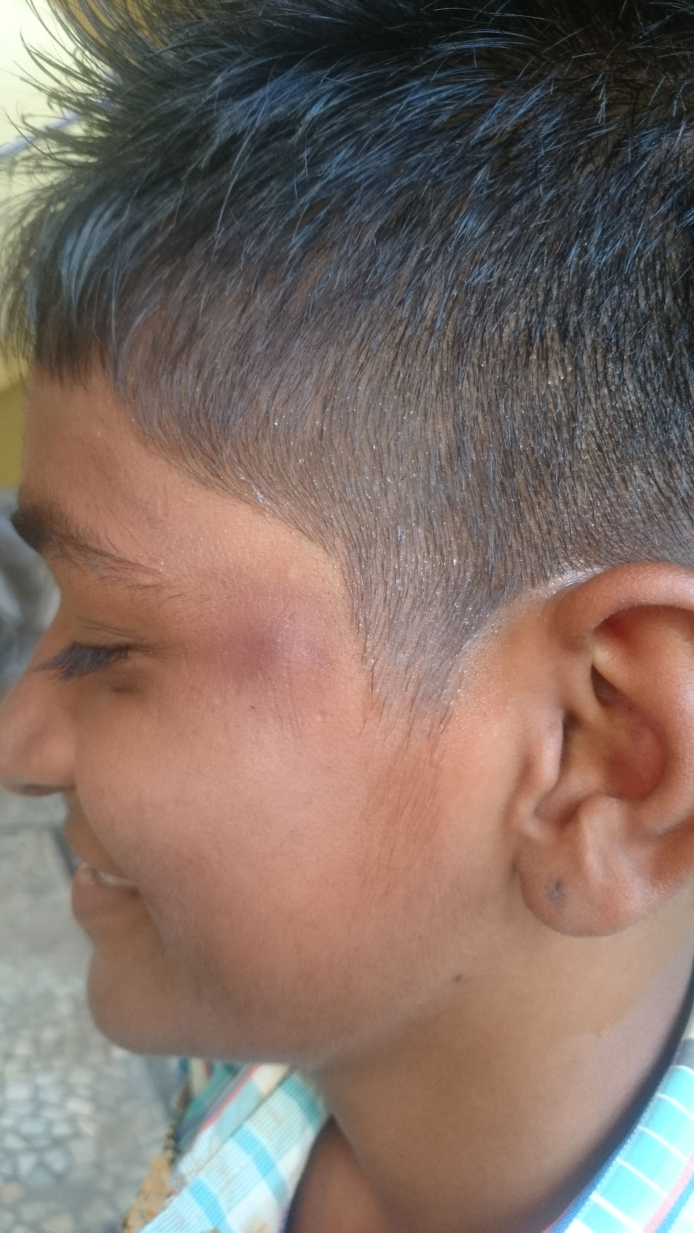 After Treatment.