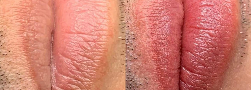 Lips blushing for men