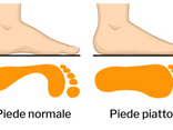 Piede piatto. Cause, sintomi e come intervenire.