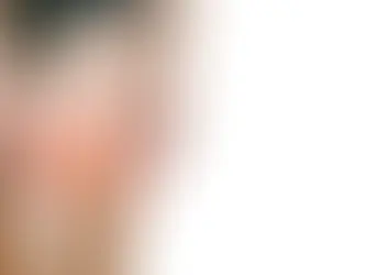 Legamento crociato anteriore, quando posso tornare a giocare?
