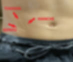 Explication de la pose d'aiguilles sur le ventre selon l'Acupuncture Abdominale pour relâcher une tension sur des muscles abducteurs de la jambe.