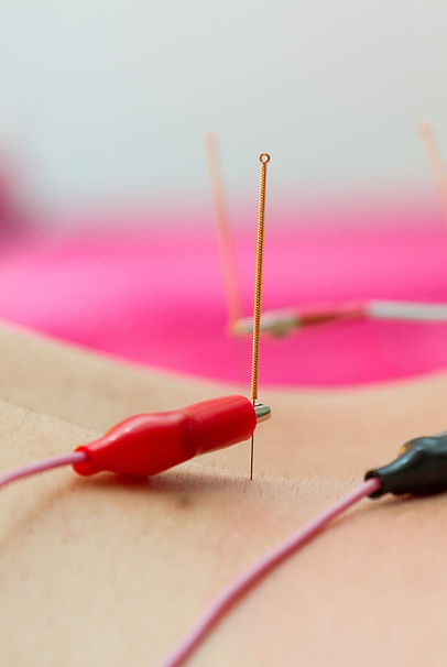 formation acupuncture scientifique de l'Ecole d'Acupuncture du Centre de Formation du Pôle de Thérapeutes