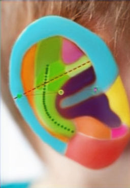 Formation auriculotherapie online - syst