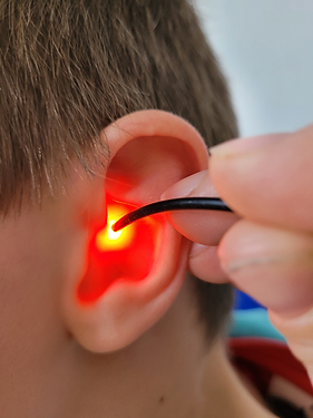 Pratique de la Formation Auriculothérapie avec Photobiomodulation (PBM) sur un enfant