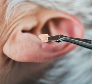 Formation Auriculotherapie Pole Thérapeu