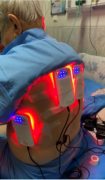 Uilisation d la Photobiomodulation (PBM) en milieu hospitalier et po la pratique de la PBM Acupunctue Non Invasive.