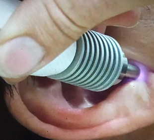 Formation Auriculotherapie laser du Pole de Therapeutes a Paris et Normandie.JPG