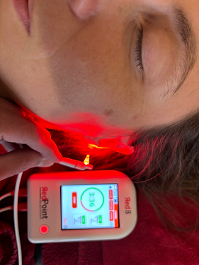 Pratique de l'Auriculothérapie avec Photobiomodulation (PBM), au lieu d'un laser.