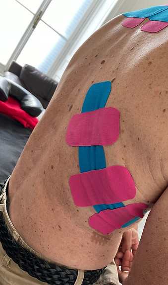 Pratique de la Formation Taping à Paris pour soulager des douleurs produits par le Zona Zoster au dos et le flanc costal.